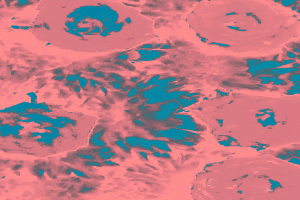 Border images / lines / design / pictures / background colors / background pictures