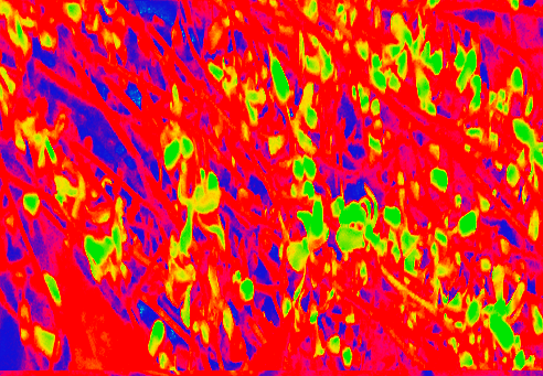 Border images / lines / design / pictures / background colors / background pictures